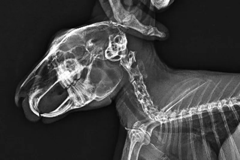 รักษาฝีรากฟัน (Root Tooth Abscess)